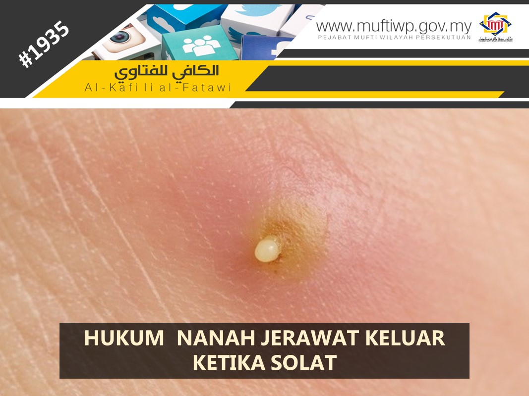 HUKUM NANAH JERAWAT KELUAR KETIKA SOLAT