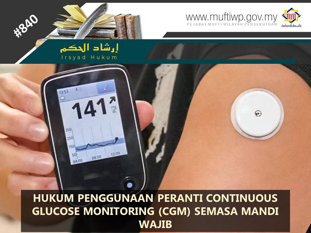 HUKUM_PENGGUNAAN_PERANTI_CONTINUOUS_GLUCOSE_MONITORING_CGM_SEMASA_MANDI_WAJIB.jpg