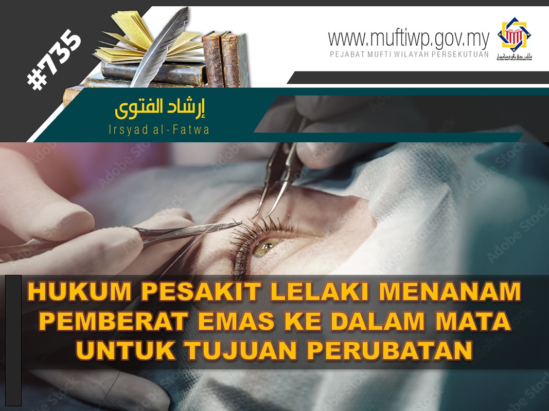 Irsyad Fatwa 735